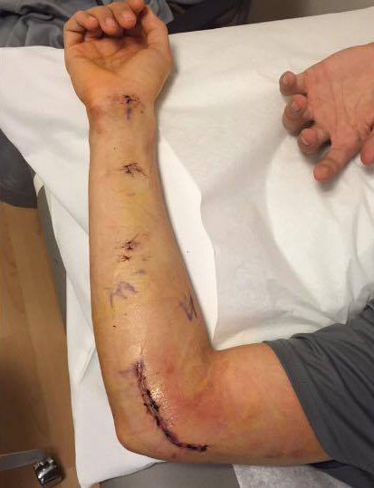 Bear Cubs' Hill recovers from surgery
