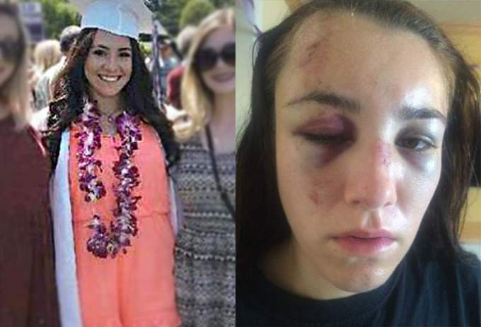 Gabbi Lemos graduating from Petaluma High School in 2015 as an all-star athlete and captain of her high school soccer team. Deputy Marcus Holton allegedly shoved Lemos’ face in her gravel driveway, causing bruising and lacerations.
